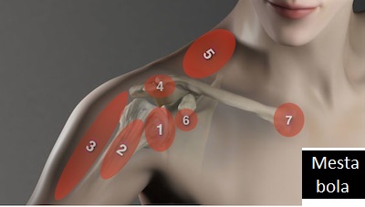 Dislokacija ramena – kako nastaje i kako liječiti ovu ozljedu? - bloodlust-uk.com