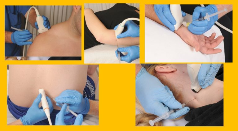 Diagnostic and therapeutic pain procedures guided by ultrasound in different pain syndromes