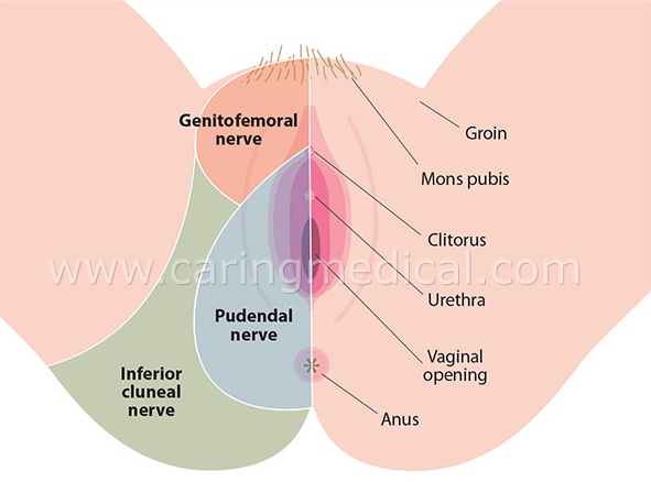 Diagram of the pudendal nerve and its branches, including perineal and anal nerves relevant to pelvic pain