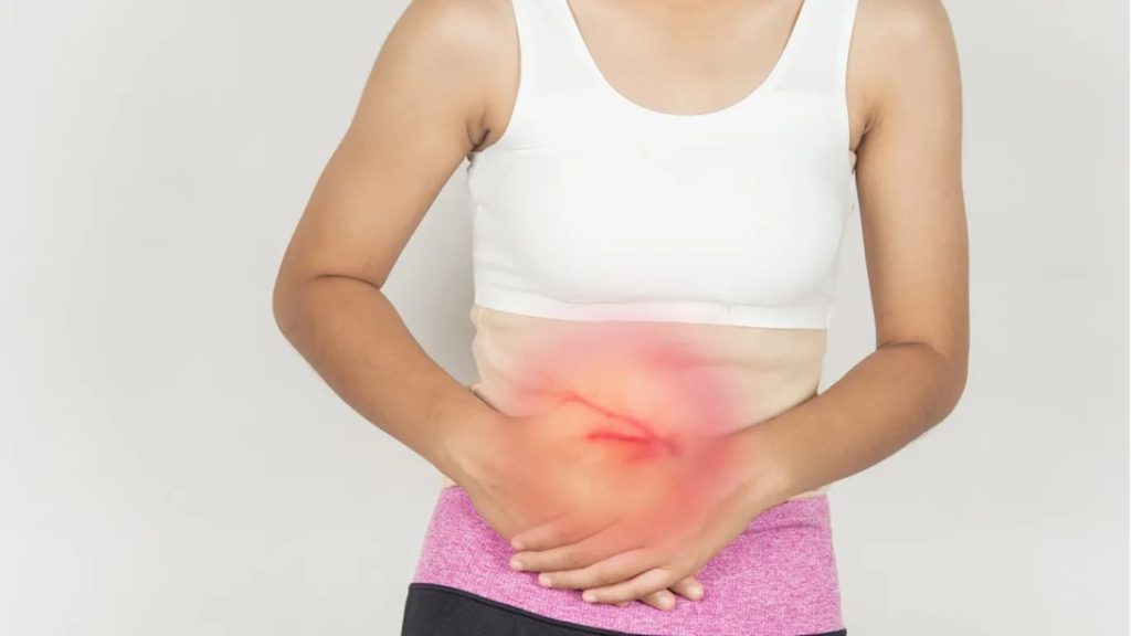 Post-cholecystectomy Pain Syndrome