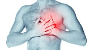 Intercostal neuralgia mimicking chest pain
