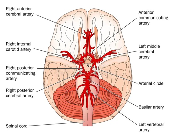 Names of the arteries at the base of the brain where an aneurysm may occur.