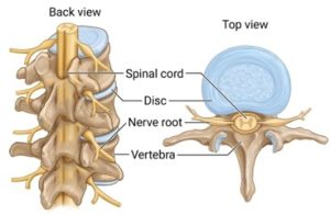 The spine is composed of vertebrae stacked one on top of the other. Inside, these bones form the spinal canal, which acts as a protective tunnel. The spinal cord and the nerve roots that branch off from it pass through this canal.