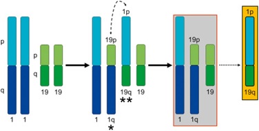 Each human cell contains 23 pairs of chromosomes, and each chromosome has a short (p) arm and a long (q) arm.The image shows a translocation between chromosomes 1 and 19, in which the short arm of chromosome 1 (1p) moves to chromosome 19, and the long arm of chromosome 19 (19q) moves to chromosome 1. One of the newly formed (rearranged) chromosomes is then lost. As a result, the cell retains one normal chromosome 1, one normal chromosome 19, and one combined chromosome (1–19), while the segments 1p and 19q are missing — this is called 1p/19q codeletion.