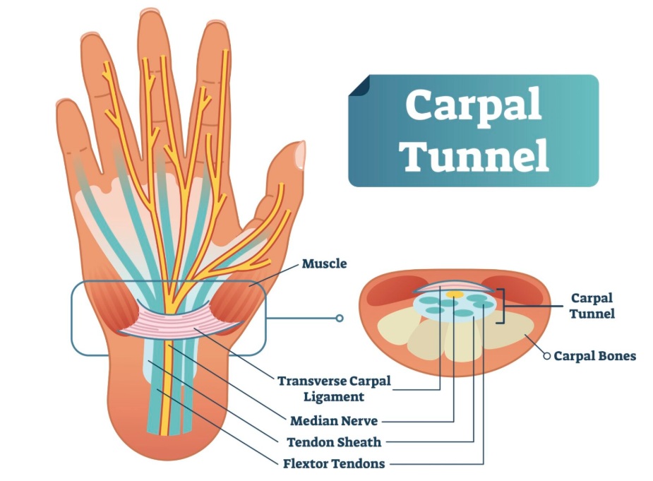 Anatomy of the carpal tunnel and the relationship of the median nerve to other anatomical structures, including the transverse carpal ligament and flexor tendons.