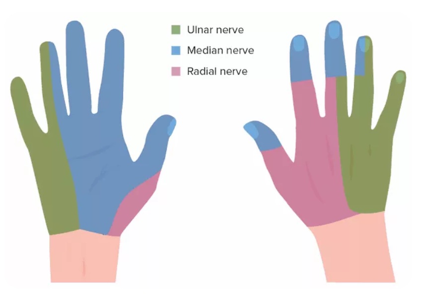 Areas of the hand affected by sensory loss following median, ulnar, or radial nerve injuries.
